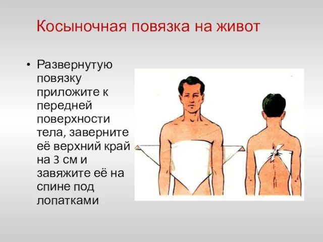 Косыночная повязка на живот Развернутую повязку приложите к передней поверхности тела, заверните