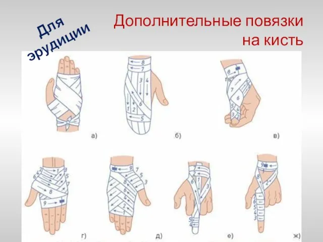 Дополнительные повязки на кисть Для эрудиции