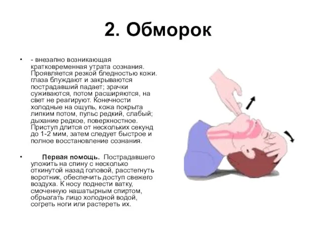 2. Обморок - внезапно возникающая кратковременная утрата сознания. Проявляется резкой бледностью кожи.