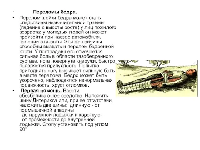 Переломы бедра. Перелом шейки бедра может стать следствием незначительной травмы (падение с