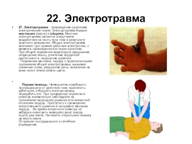 22. Электротравма 27. Электротравма - повреждение организма электрическим током. Электротравмы бывают местными