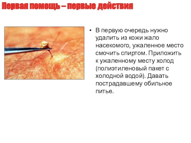 В первую очередь нужно удалить из кожи жало насекомого, ужаленное место смочить