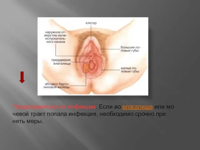 Пре­до­хра­нять­ся от ­инфекции. Ес­ли во влага­лище или мо­че­вой тракт по­па­ла инфекция, не­об­хо­димо сроч­но при­нять ме­ры.