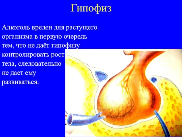 Гипофиз Алкоголь вреден для растущего организма в первую очередь тем, что не