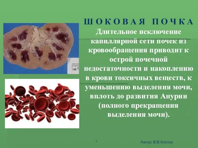 ШОК - ЭТО АКТИВНАЯ ЗАЩИТА ОРГАНИЗМА ОТ АГРЕССИИ СРЕДЫ Ш О К