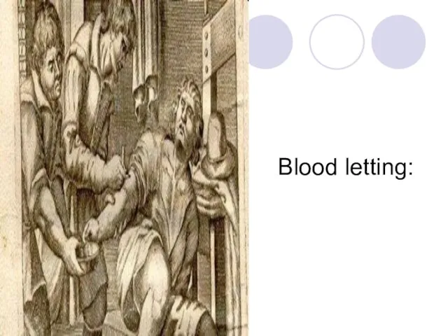 Blood letting: