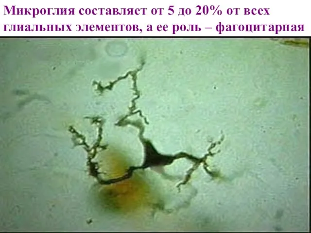 Микроглия составляет от 5 до 20% от всех глиальных элементов, а ее роль – фагоцитарная