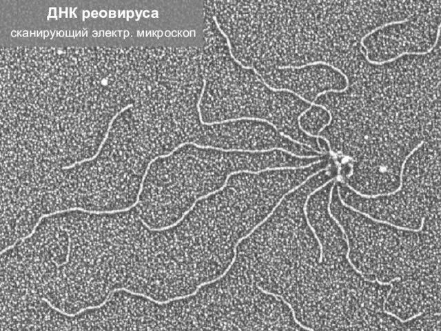ДНК реовируса сканирующий электр. микроскоп