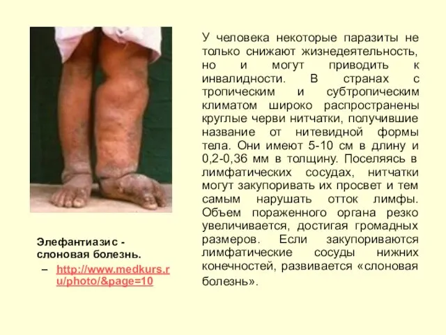 Элефантиазис - cлоновая болезнь. http://www.medkurs.ru/photo/&page=10 У человека некоторые паразиты не только снижают