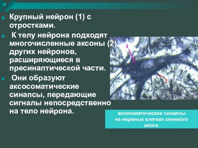 Крупный нейрон (1) с отростками. К телу нейрона подходят многочисленные аксоны (2)