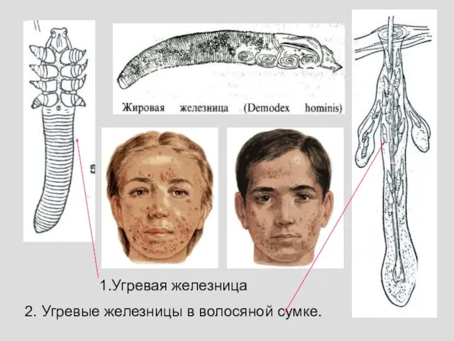 1.Угревая железница 2. Угревые железницы в волосяной сумке.