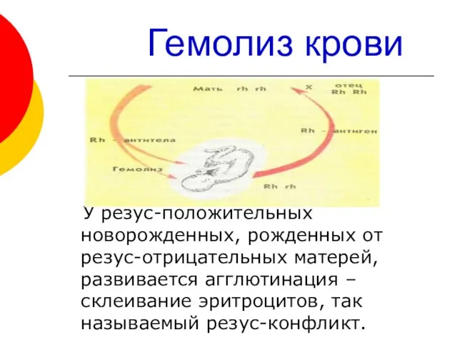 Гемолиз крови У резус-положительных новорожденных, рожденных от резус-отрицательных матерей, развивается агглютинация –