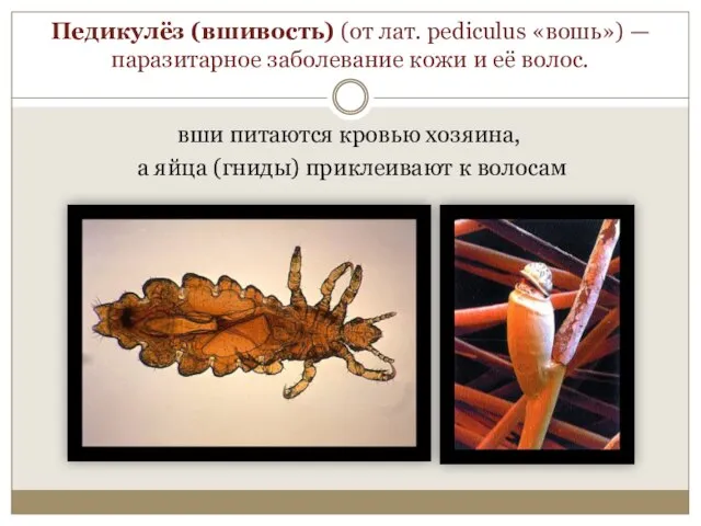 Педикулёз (вшивость) (от лат. pediculus «вошь») — паразитарное заболевание кожи и её