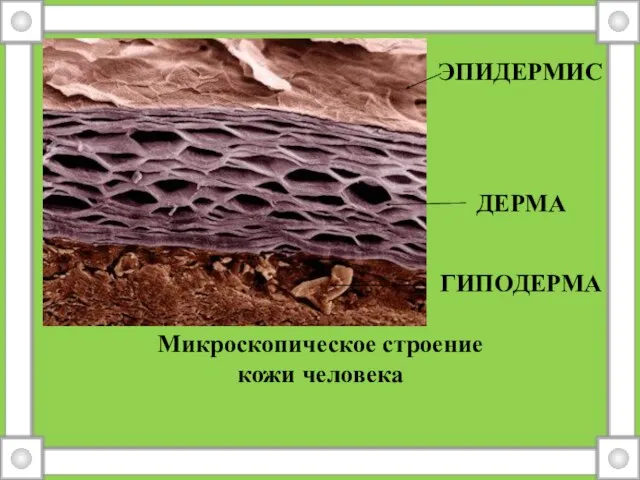 Микроскопическое строение кожи человека эпидермис Дерма гипоДерма