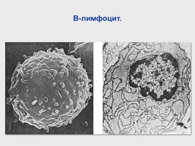 В-лимфоцит.