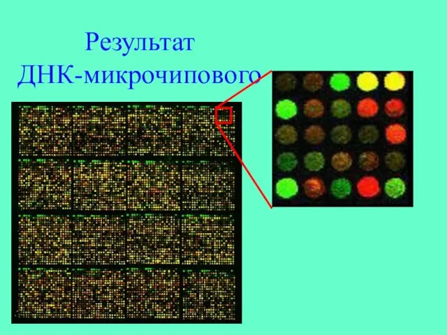 Результат ДНК-микрочипового исследования