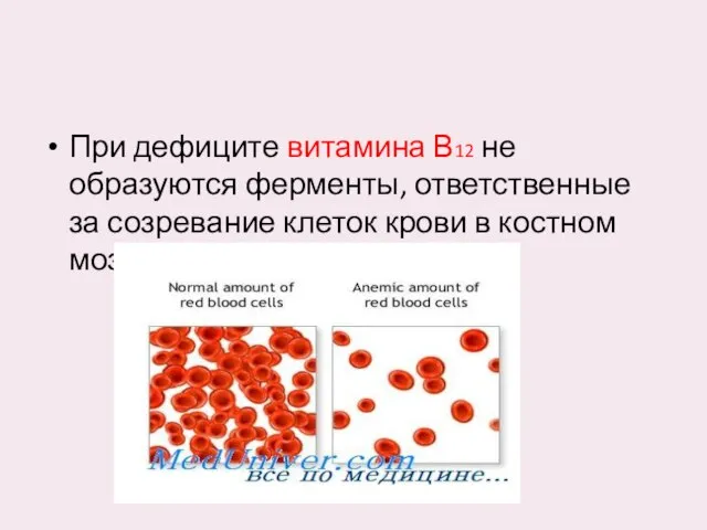 При дефиците витамина В12 не образуются ферменты, ответственные за созревание клеток крови в костном мозге