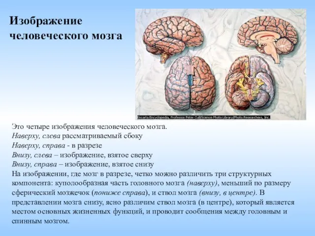 Это четыре изображения человеческого мозга. Наверху, слева рассматриваемый сбоку Наверху, справа -