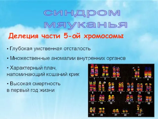 синдром мяуканья Делеция части 5-ой хромосомы