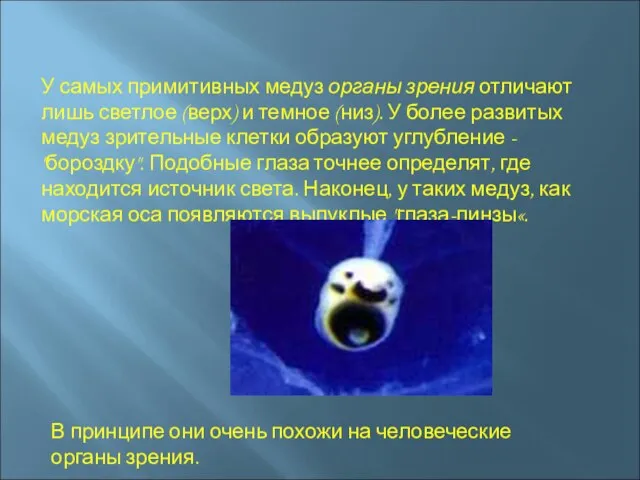 У самых примитивных медуз органы зрения отличают лишь светлое (верх) и темное