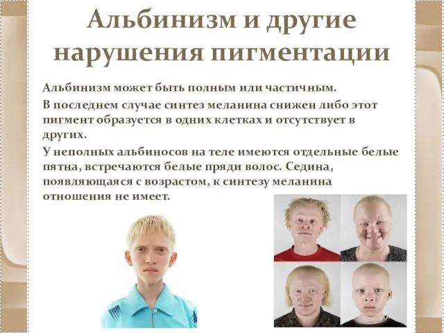 Альбинизм и другие нарушения пигментации Альбинизм может быть полным или частичным. В