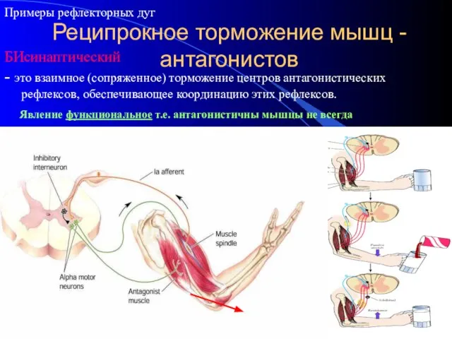 Реципрокное торможение мышц - антагонистов - это взаимное (сопряженное) торможение центров антагонистических