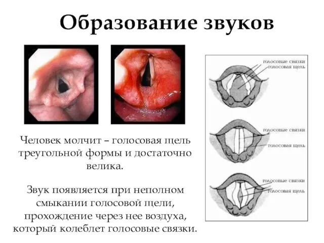 Образование звуков Человек молчит – голосовая щель треугольной формы и достаточно велика.