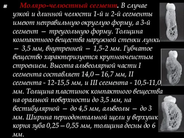 Моляро-челюстный сегмент. В случае узкой и длинной челюсти 1-й и 2-й сегменты