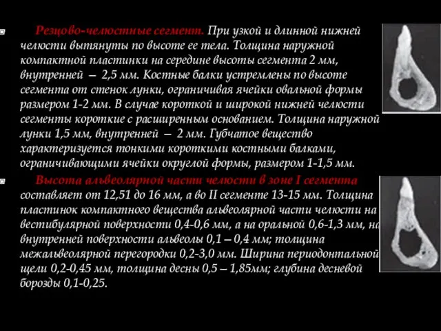 Резцово-челюстные сегмент. При узкой и длинной нижней челюсти вытянуты по высоте ее