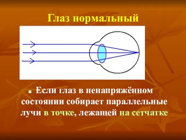 Глаз нормальный Если глаз в ненапряжённом состоянии собирает параллельные лучи в точке, лежащей на сетчатке