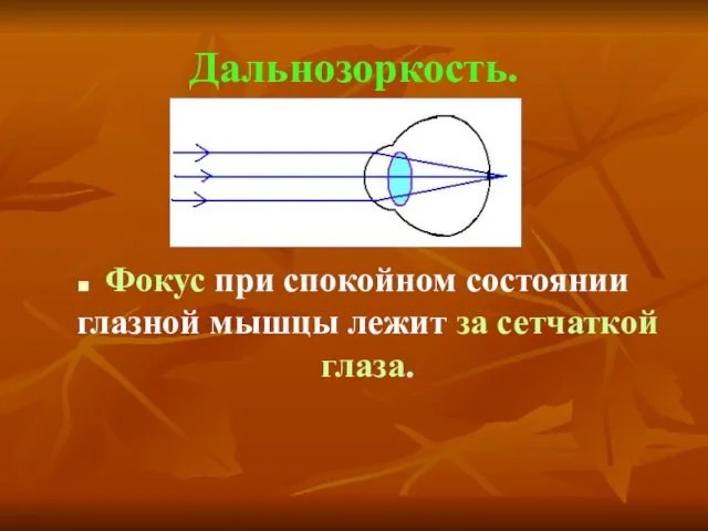 Дальнозоркость. Фокус при спокойном состоянии глазной мышцы лежит за сетчаткой глаза.