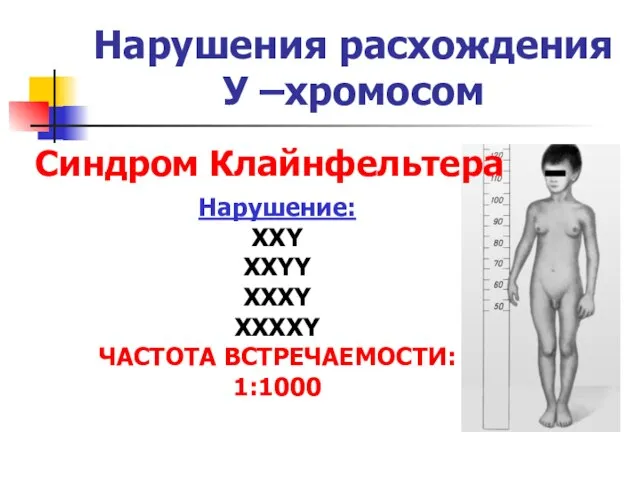 Нарушения расхождения У –хромосом Синдром Клайнфельтера Нарушение: XXY XXYY XXXY XXXXY ЧАСТОТА ВСТРЕЧАЕМОСТИ: 1:1000