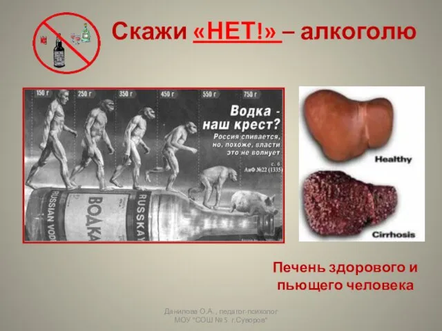 Скажи «НЕТ!» – алкоголю Печень здорового и пьющего человека Данилова О.А. ,