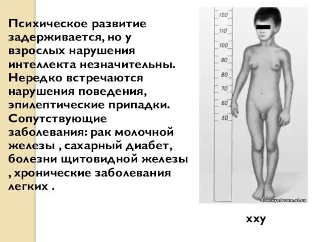 хxy Xхyy ххy Психическое развитие задерживается, но у взрослых нарушения интеллекта незначительны.