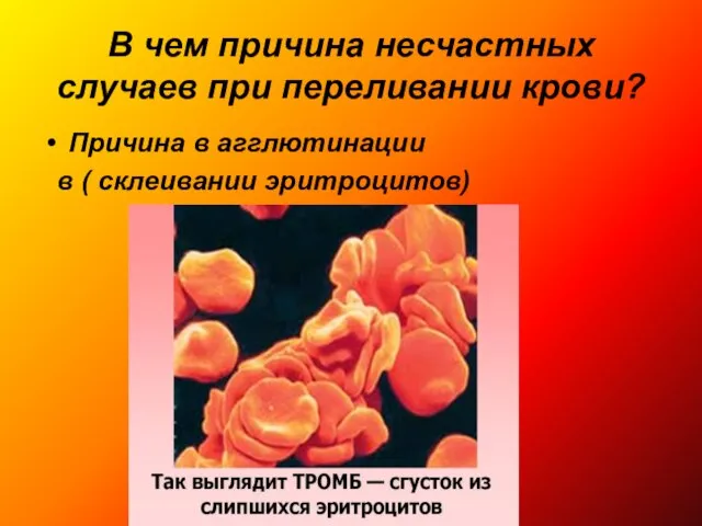 В чем причина несчастных случаев при переливании крови? Причина в агглютинации в ( склеивании эритроцитов)