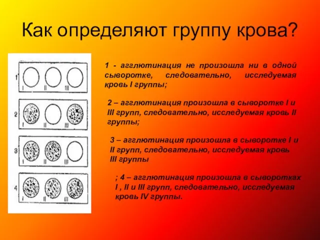 Как определяют группу крова? 1 - агглютинация не произошла ни в одной