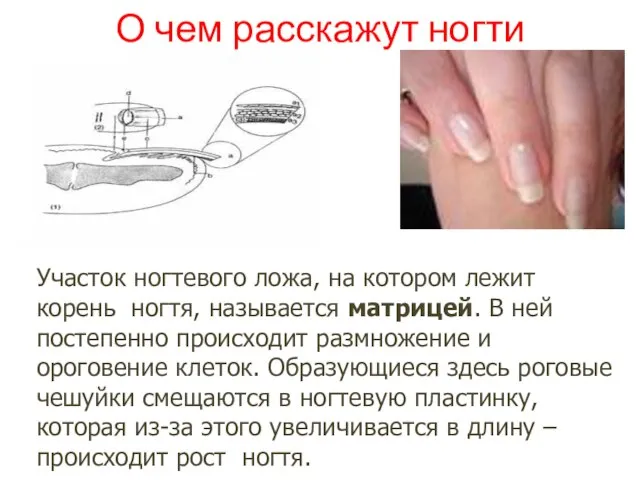 О чем расскажут ногти Участок ногтевого ложа, на котором лежит корень ногтя,