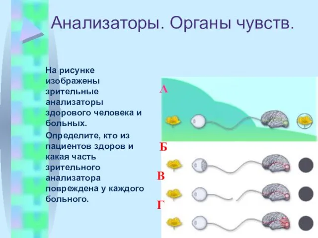 Анализаторы. Органы чувств. На рисунке изображены зрительные анализаторы здорового человека и больных.