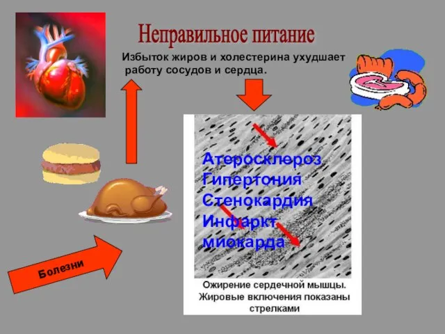 Неправильное питание Избыток жиров и холестерина ухудшает работу сосудов и сердца. Атеросклероз