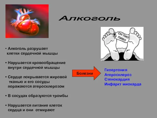 Алкоголь Алкоголь разрушает клетки сердечной мышцы Нарушается кровообращение внутри сердечной мышцы Сердце