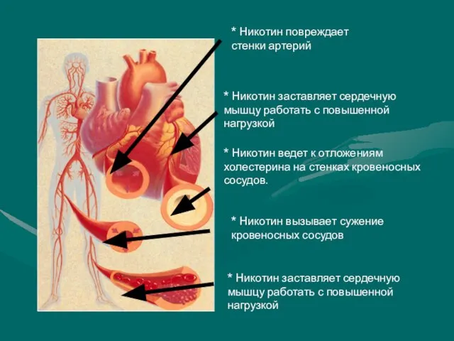 * Никотин вызывает сужение кровеносных сосудов * Никотин ведет к отложениям холестерина