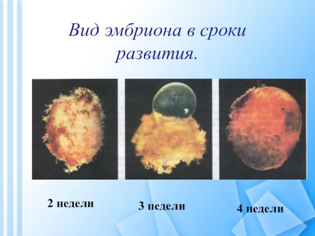 Вид эмбриона в сроки развития. 2 недели 3 недели 4 недели