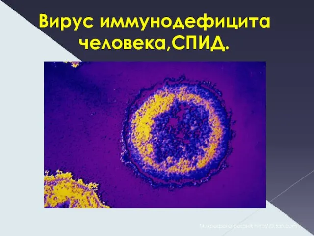 Вирус иммунодефицита человека,СПИД. Микрофотография: http://0.tqn.com