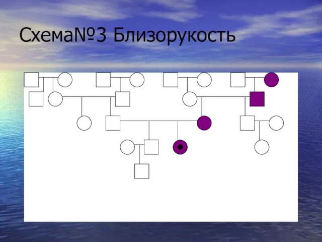 Схема№3 Близорукость