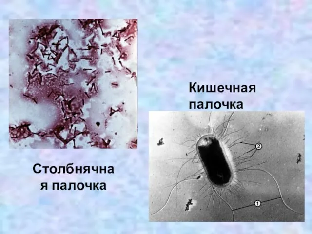 Столбнячная палочка Кишечная палочка