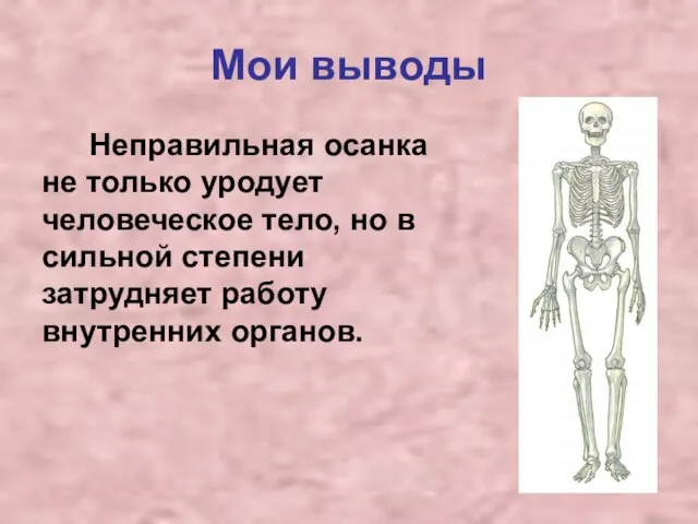 Мои выводы Неправильная осанка не только уродует человеческое тело, но в сильной