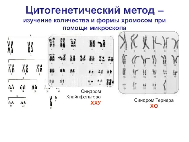 Цитогенетический метод – изучение количества и формы хромосом при помощи микроскопа Синдром