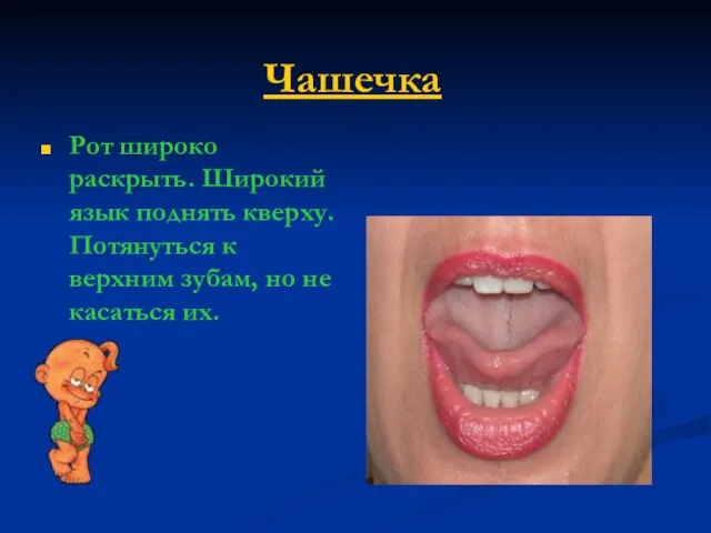 Чашечка Рот широко раскрыть. Широкий язык поднять кверху. Потянуться к верхним зубам, но не касаться их.