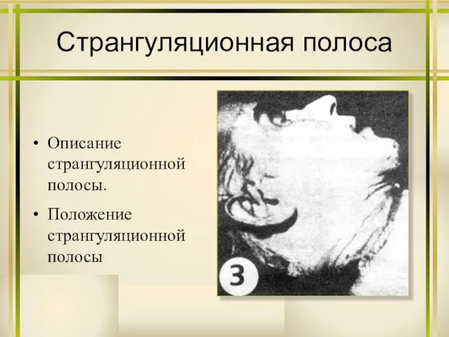 Странгуляционная полоса Описание странгуляционной полосы. Положение странгуляционной полосы