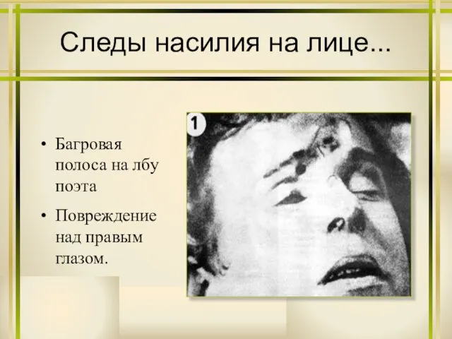 Следы насилия на лице... Багровая полоса на лбу поэта Повреждение над правым глазом.